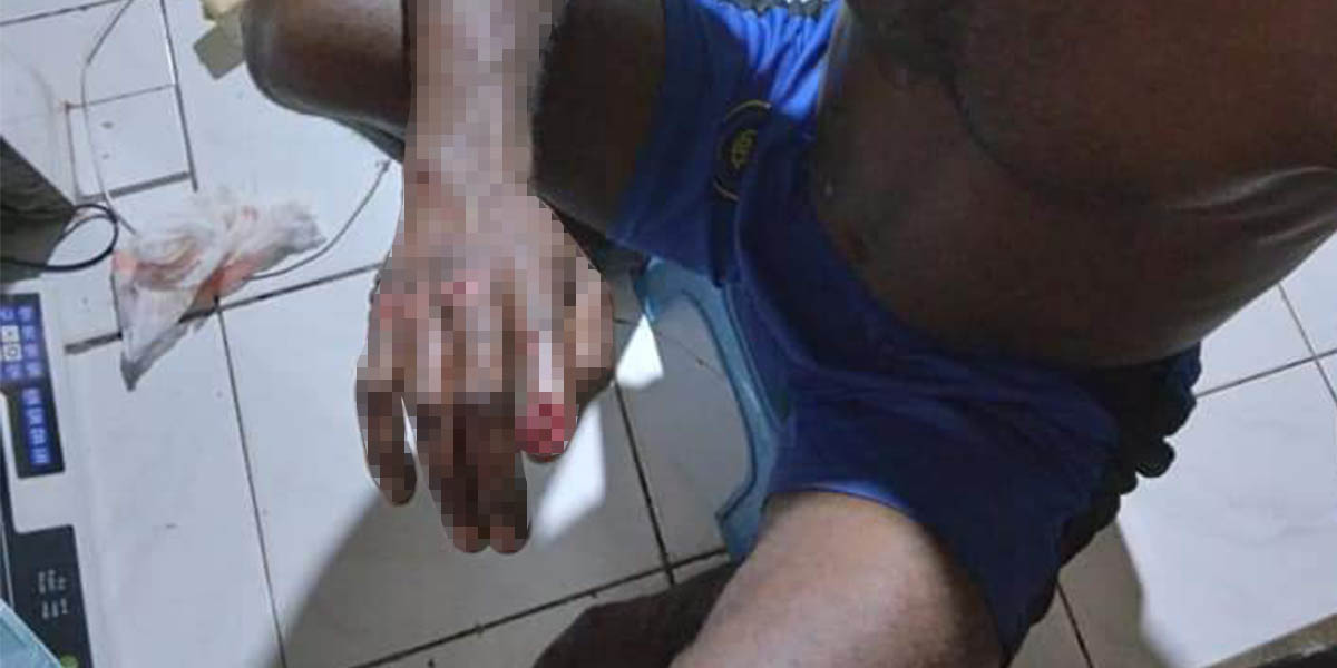 sadis-seorang-nelayan-dianiaya-hingga-kuku-jarinya-dicabut